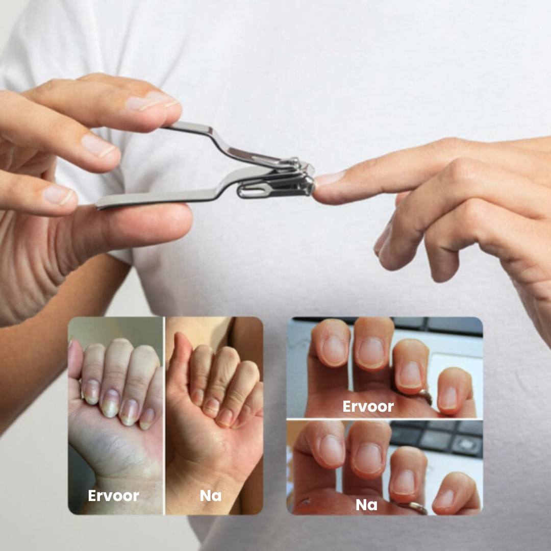360° Roteerbare Nagelschaar